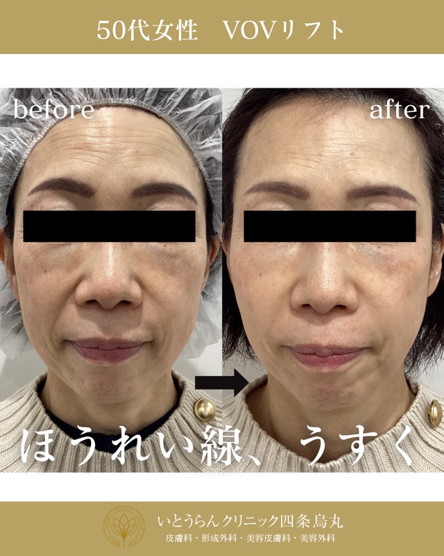 No.3034の症例写真 No.3034の症例写真