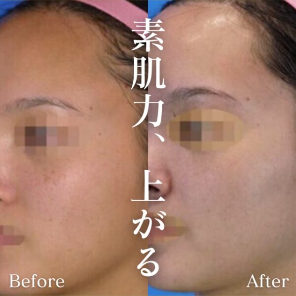 No.2759の症例写真