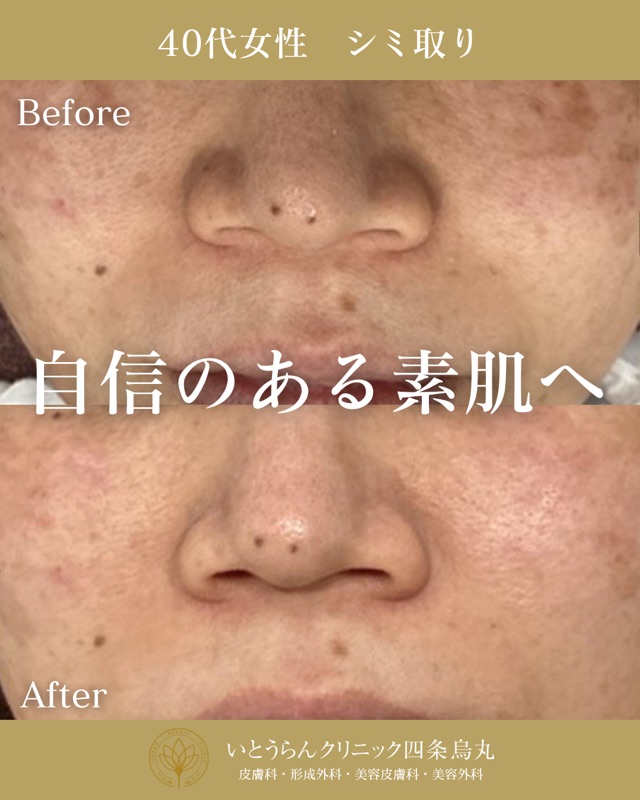 No.2788の症例写真