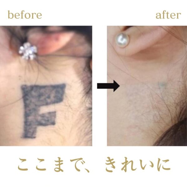 No.2807の症例写真