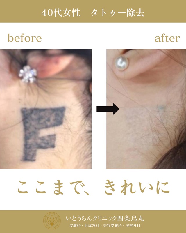 No.2807の症例写真 No.2807の症例写真