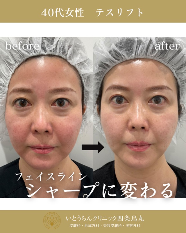 No.3039の症例写真 No.3039の症例写真