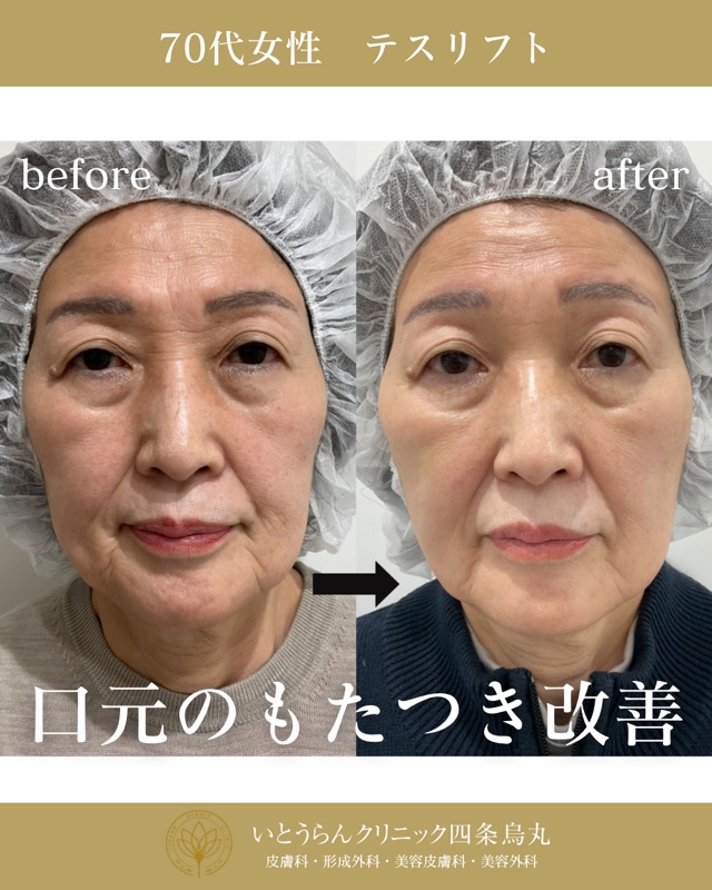 No.3028の症例写真 No.3028の症例写真