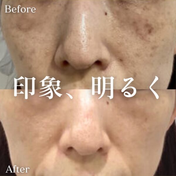 No.2781の症例写真