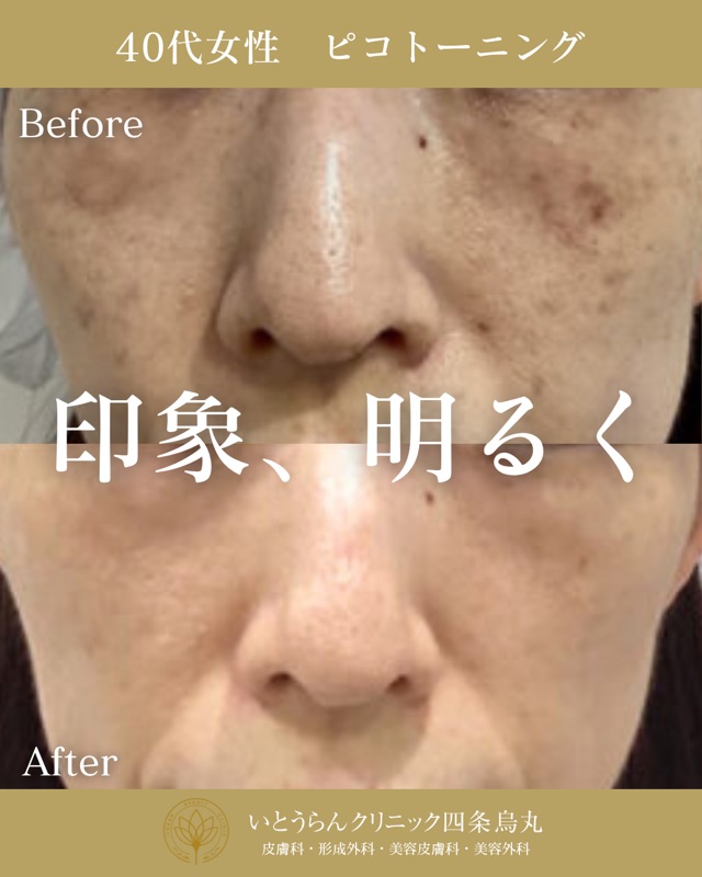 No.2781の症例写真 No.2781の症例写真