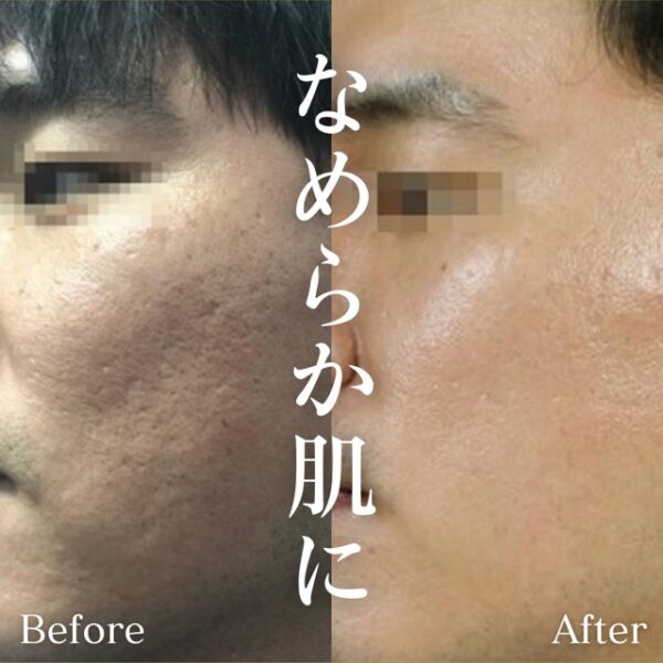 No.2728の症例写真