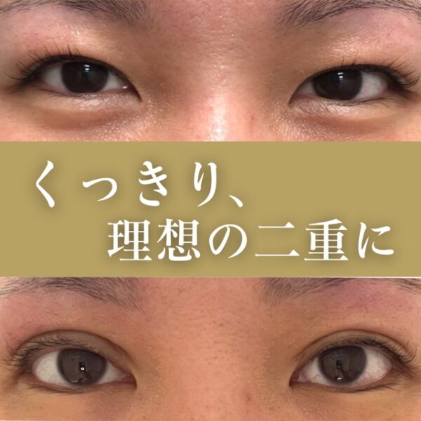 No.2802の症例写真
