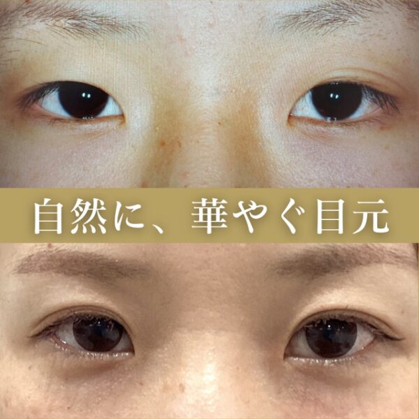 No.2797の症例写真