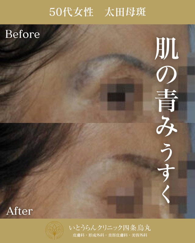 No.2770の症例写真 No.2770の症例写真