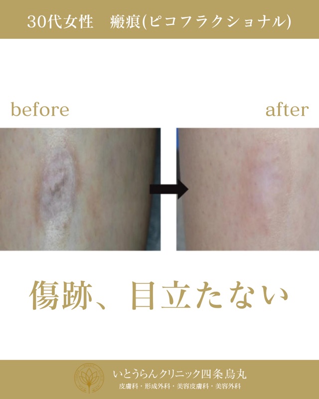 No.2738の症例写真