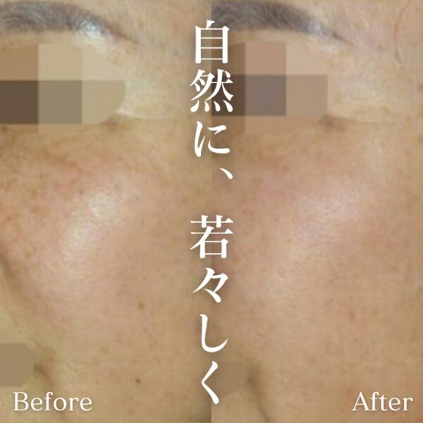 No.2754の症例写真