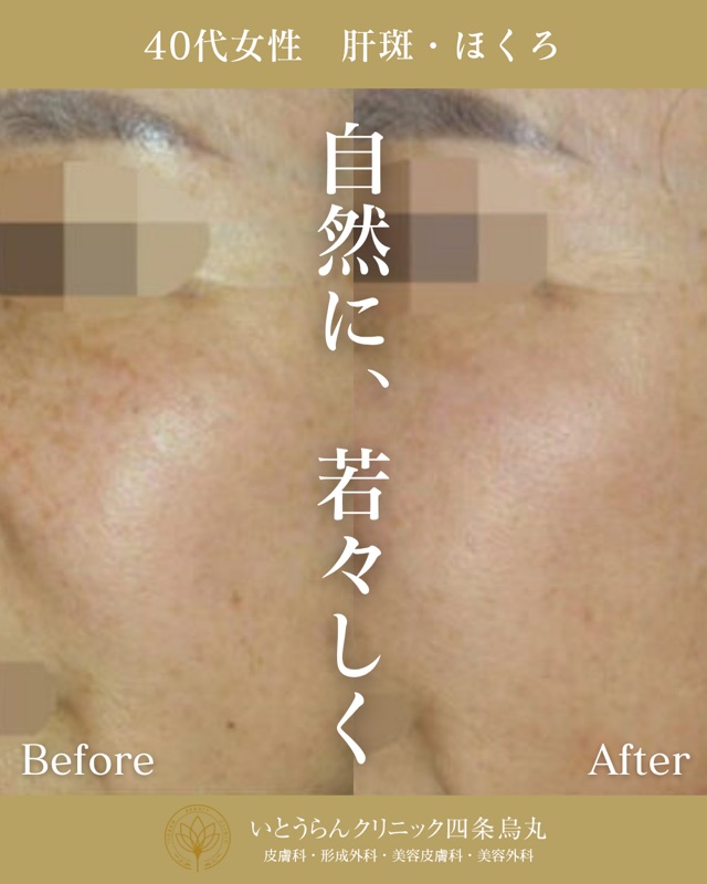 No.2754の症例写真 No.2754の症例写真