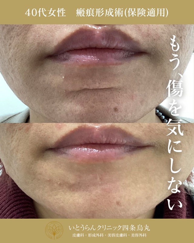 No.3092の症例写真 No.3092の症例写真