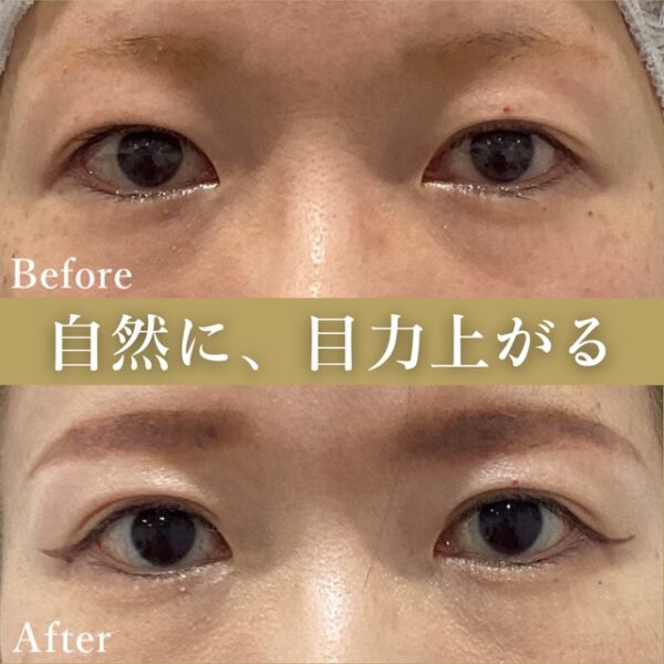 No.4174の症例写真