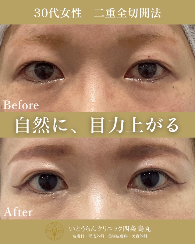 No.4174の症例写真