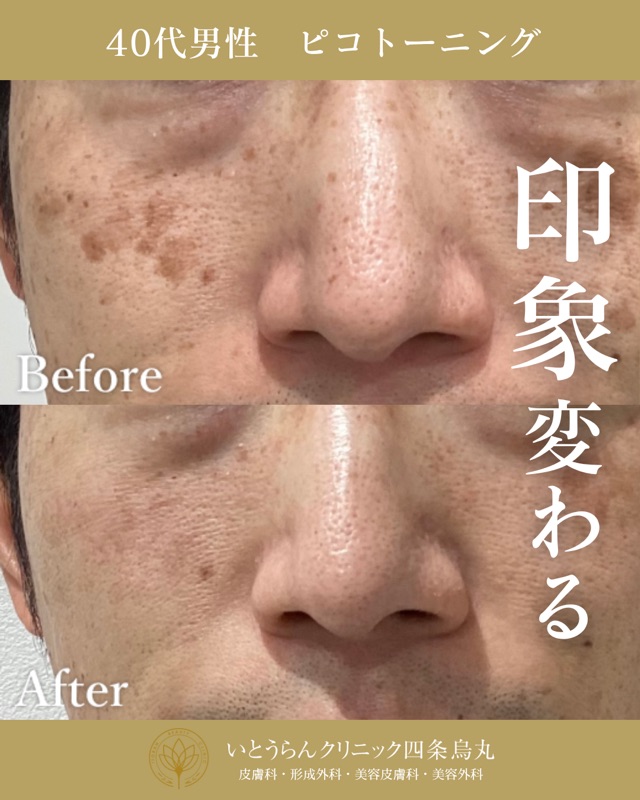 No.4317の症例写真 No.4317の症例写真