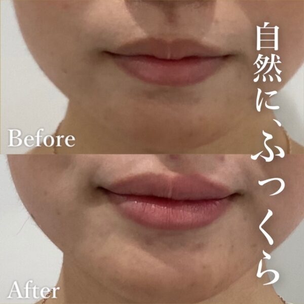 No.4313の症例写真