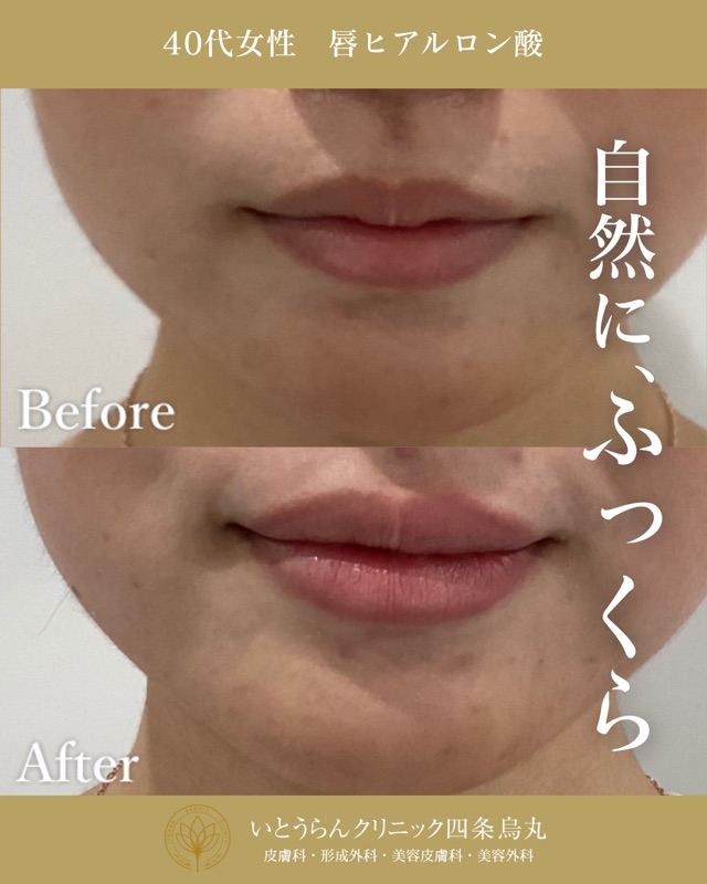 No.4313の症例写真