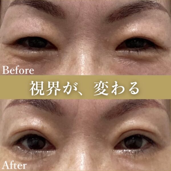 No.4306の症例写真