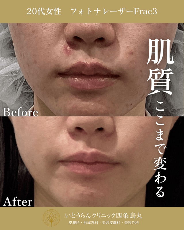 No.4662の症例写真