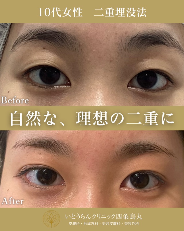 No.4651の症例写真 No.4651の症例写真