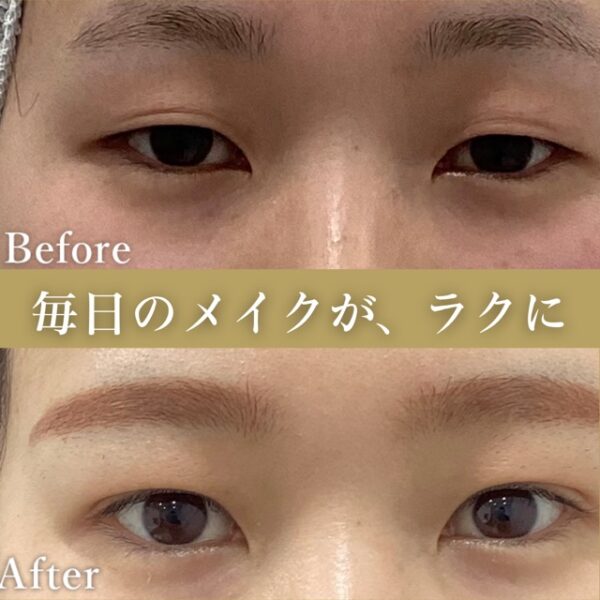 No.4549の症例写真
