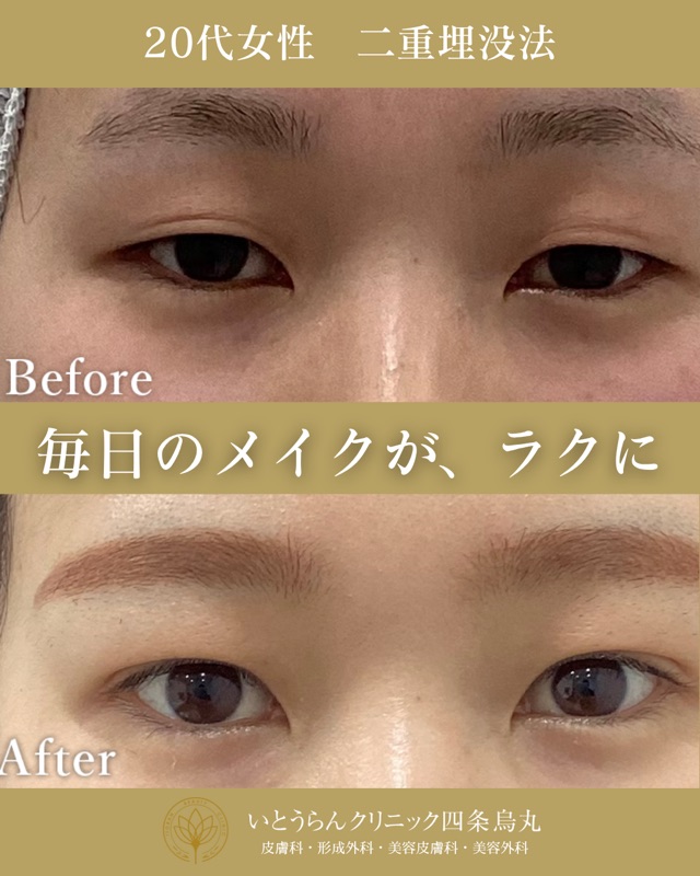 No.4549の症例写真 No.4549の症例写真