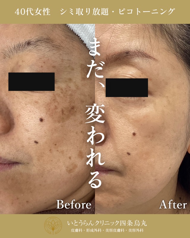 No.4963の症例写真 No.4963の症例写真
