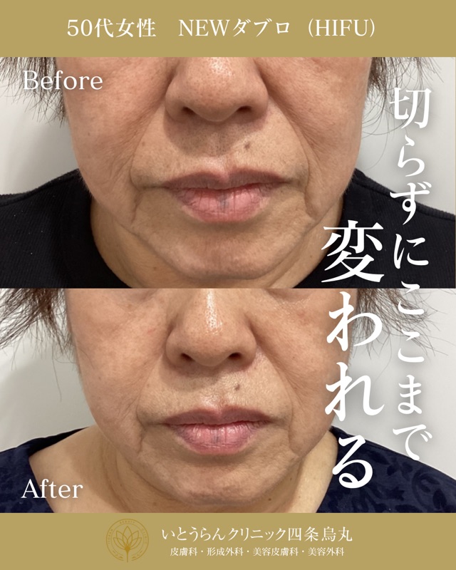 No.4971の症例写真