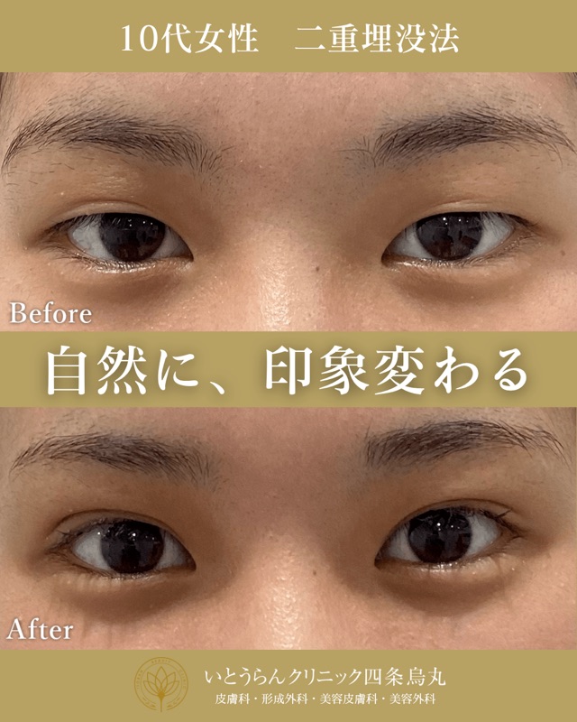 No.4891の症例写真 No.4891の症例写真