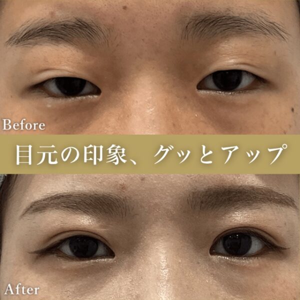 No.4896の症例写真
