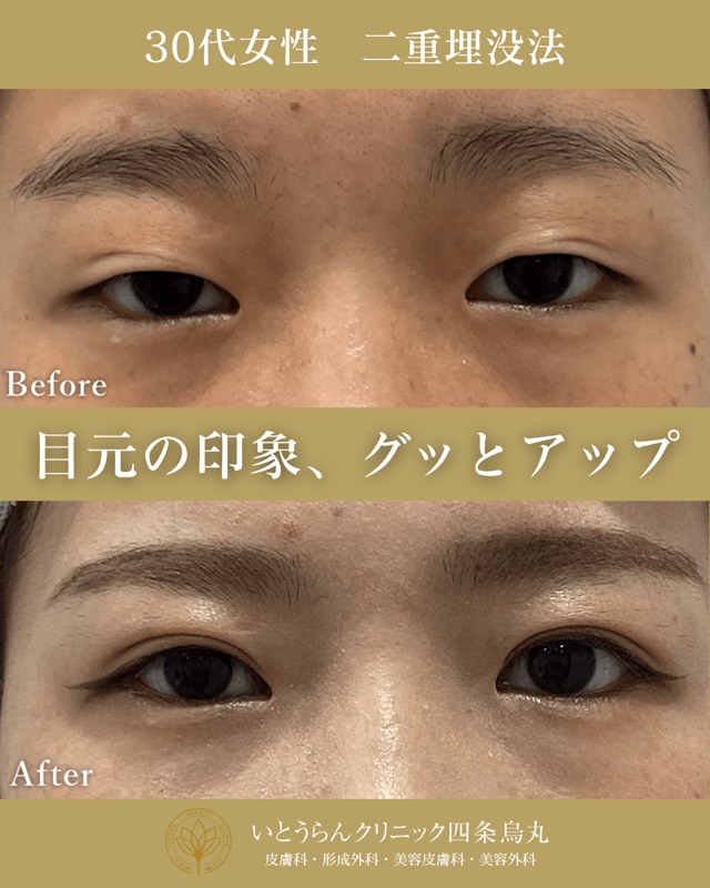 No.4896の症例写真