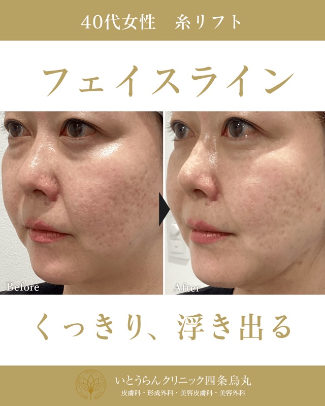 No.4900の症例写真 No.4900の症例写真