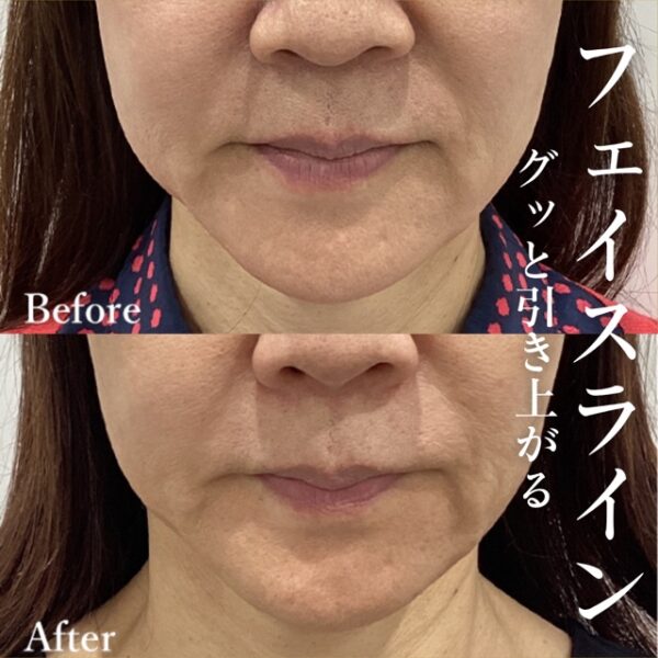 No.5502の症例写真