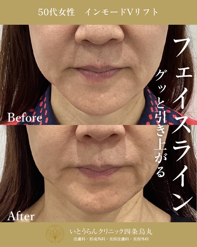 No.5502の症例写真 No.5502の症例写真