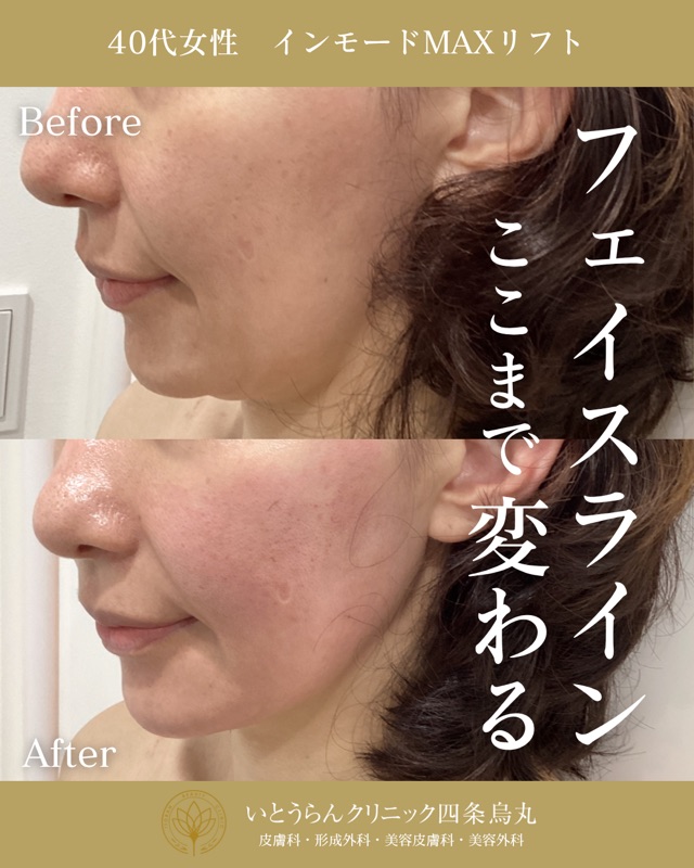No.5506の症例写真 No.5506の症例写真