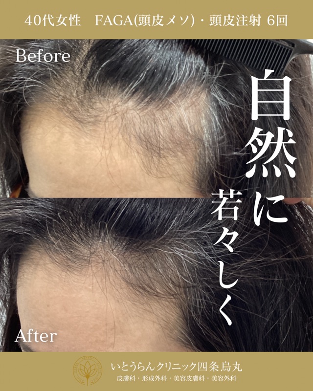 No.6111の症例写真 No.6111の症例写真