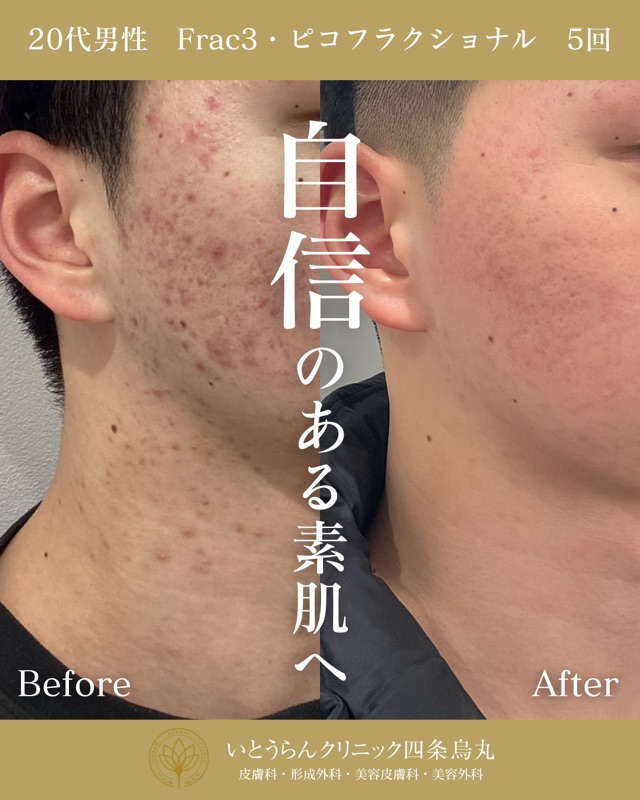 No.6108の症例写真 No.6108の症例写真