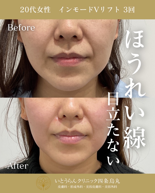 No.8103の症例写真 No.8103の症例写真