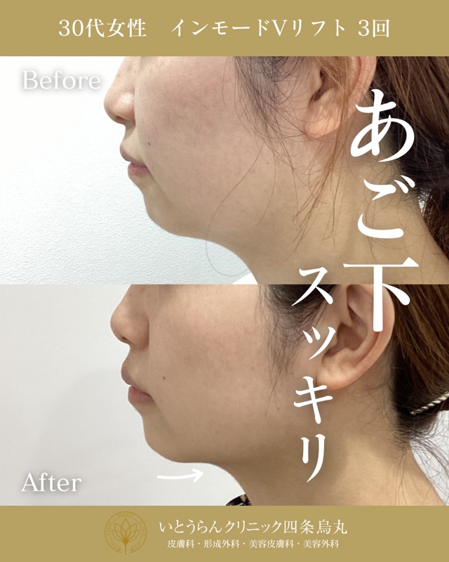 No.8098の症例写真 No.8098の症例写真