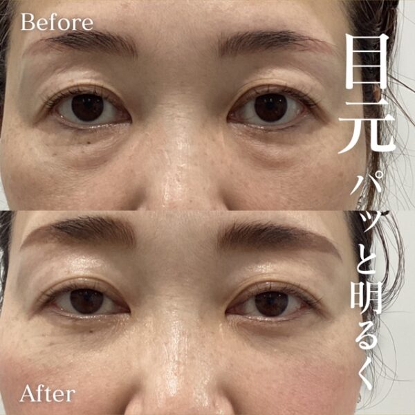 No.8082の症例写真