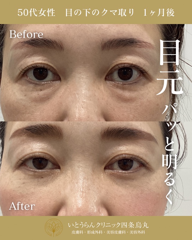 No.8082の症例写真