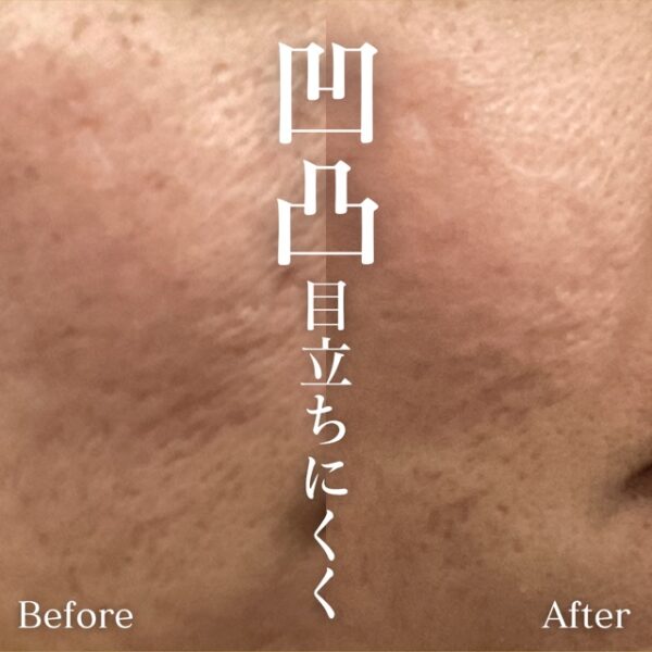 No.8078の症例写真