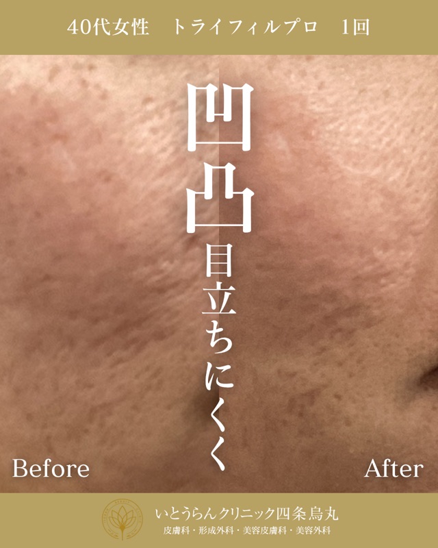 No.8078の症例写真