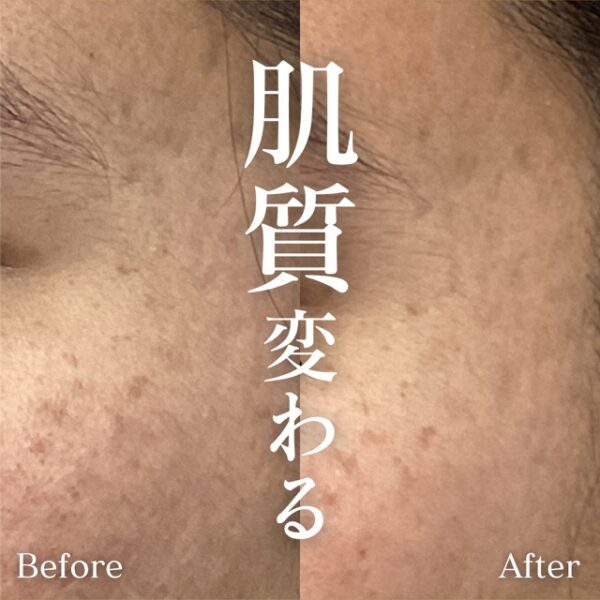 No.8075の症例写真