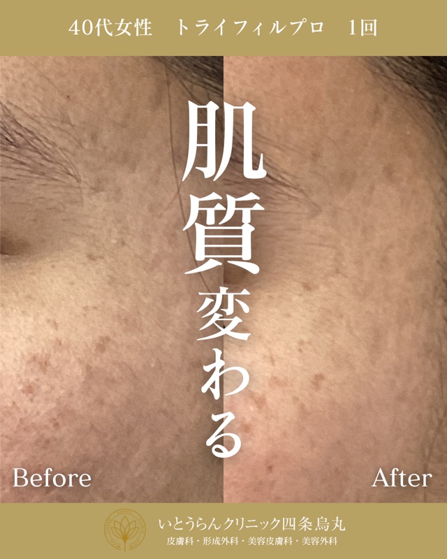 No.8075の症例写真 No.8075の症例写真