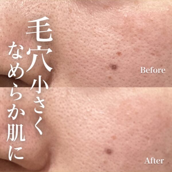 No.8085の症例写真