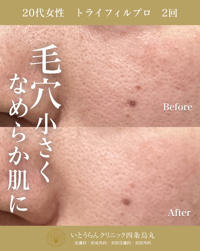 No.8085の症例写真 No.8085の症例写真