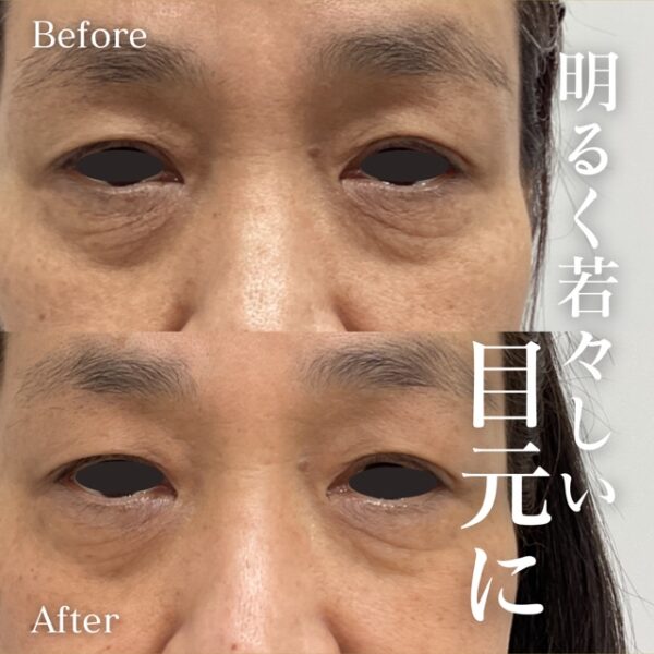 No.8740の症例写真