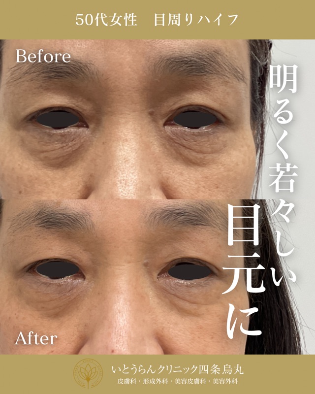 No.8740の症例写真 No.8740の症例写真